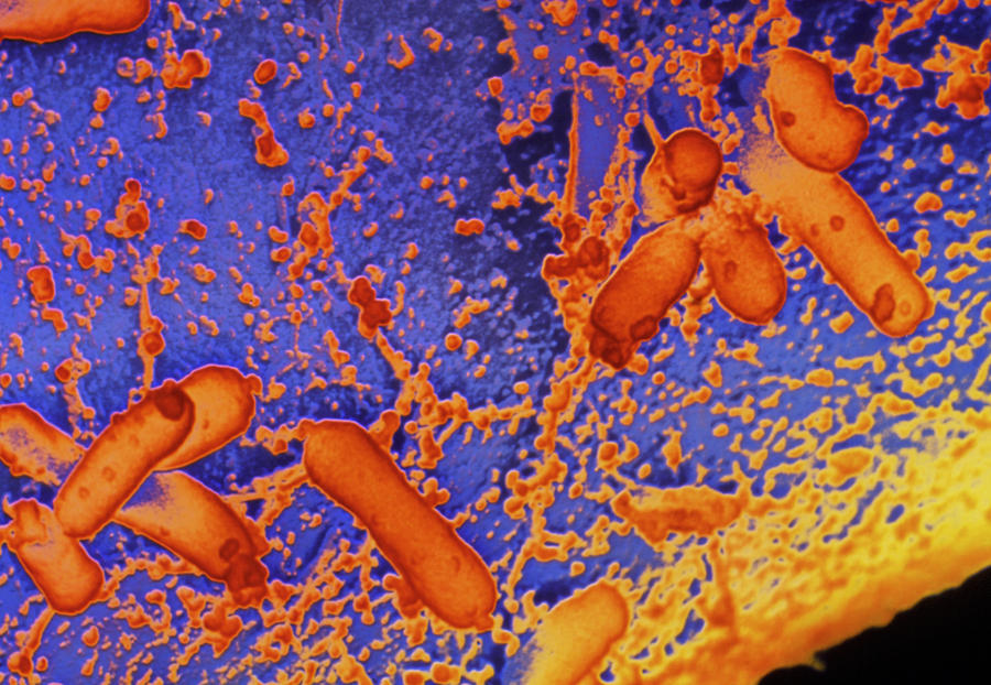 False-col Sem Of Rhizobium Leguminosarum Photograph by Dr Jeremy Burgess/science Photo Library