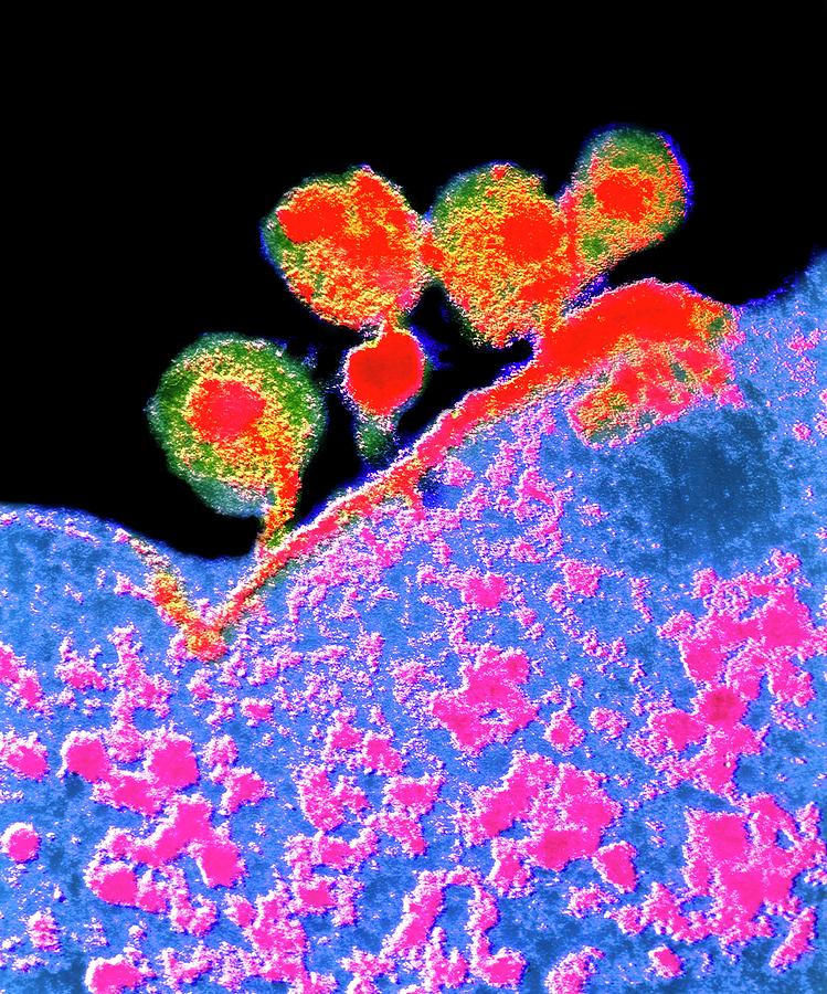 False-col Tem Of Aids Virus Budding From T4 Cell Photograph by Cnri/science Photo Library