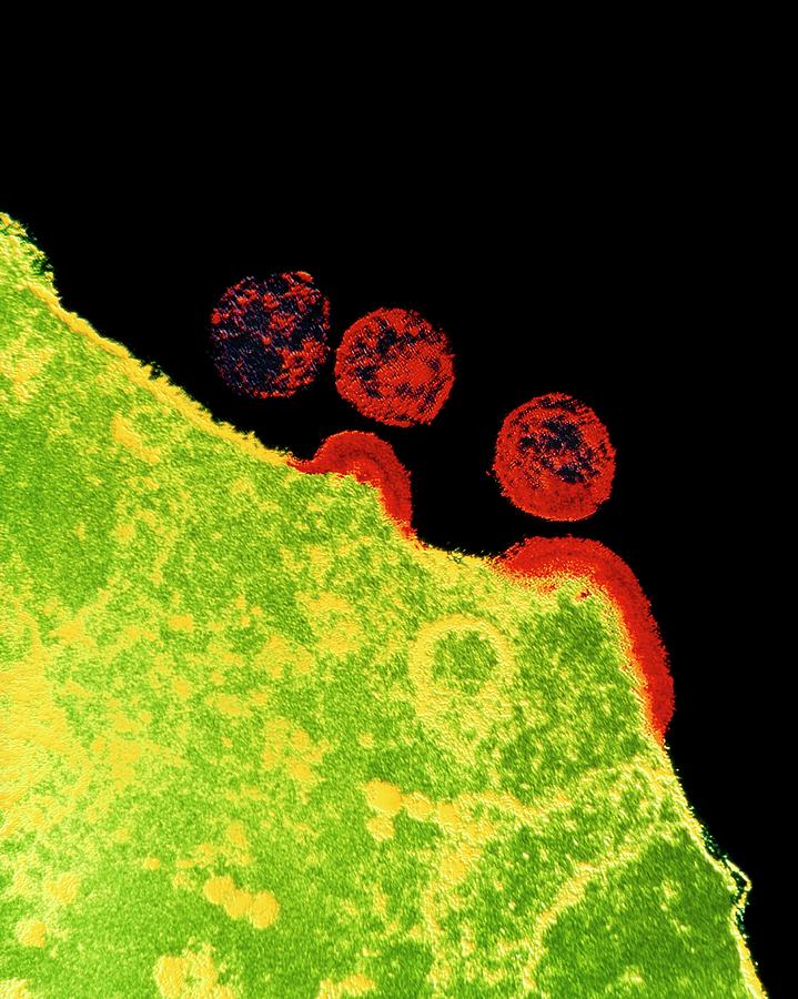 False-col Tem Of Aids Virus Replication In T-cell Photograph by University Of Medicine & Dentistry Of New Jersey/science Photo Library