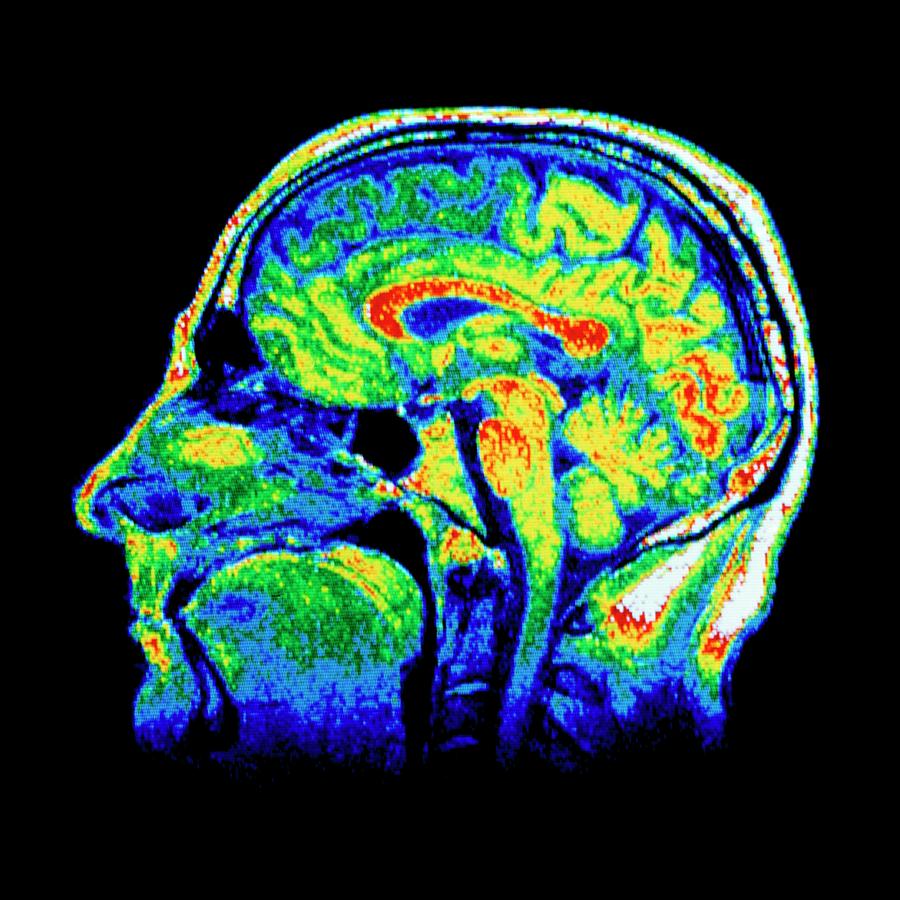 False-colour Mri Scan Of The Head Photograph by Cnri/science Photo Library