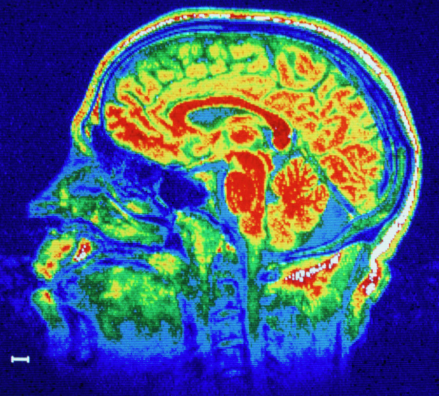 False-colour Sagittal Nmr Scan Of A Child's Head Photograph by Cnri ...