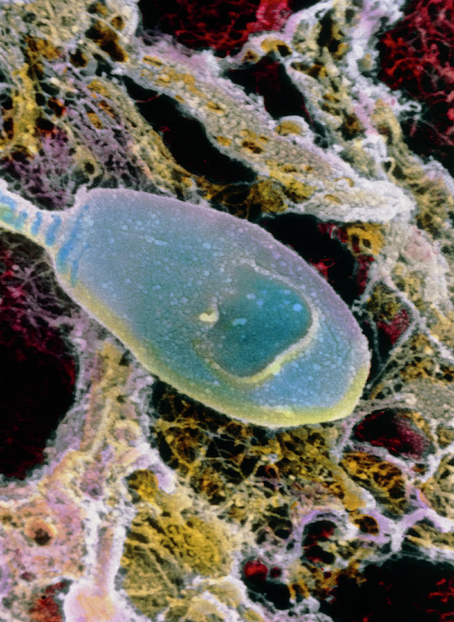 False-colour Sem Of A Spermatozoon On Egg Surface Photograph by Prof. P. Motta/dept. Of Anatomy/university \la Sapienza\, Rome/science Photo Library