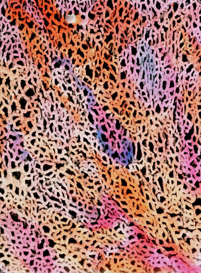 False-colour Sem Of Microvascular Cast Of Lung Photograph by Motta & Macchiarelli/anatomy Dept./univ. \la Sapienza\, Rome/science Photo Library