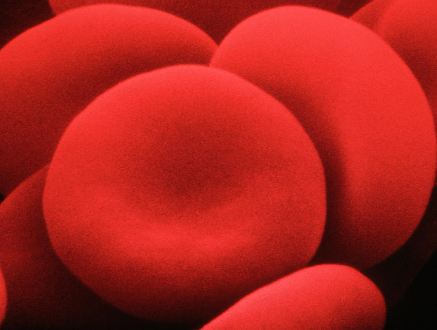 False-colour Sem Of Normal Human Red Blood Cells Photograph by Dr. Tony Brain/science Photo Library.