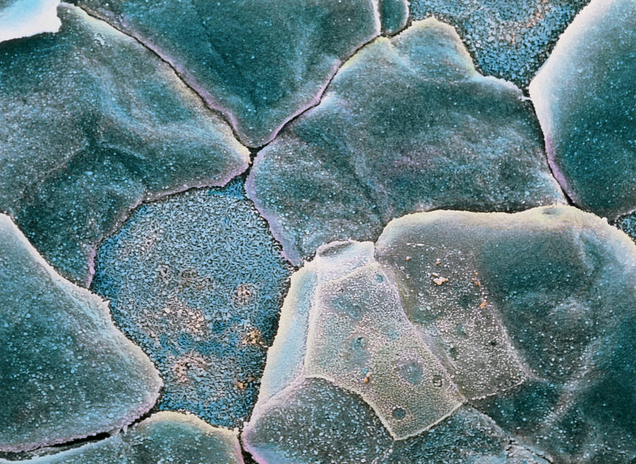 False-colour Sem Of The Cell Surface Of The Cornea Photograph by Prof. P. Motta/dept. Of Anatomy/university \la Sapienza\, Rome/science Photo Library