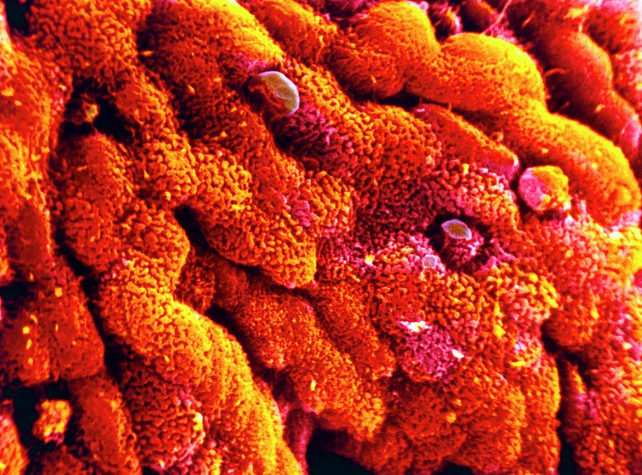False-colour Sem Of The Wall Of The Human Colon Photograph by Cnri/science Photo Library