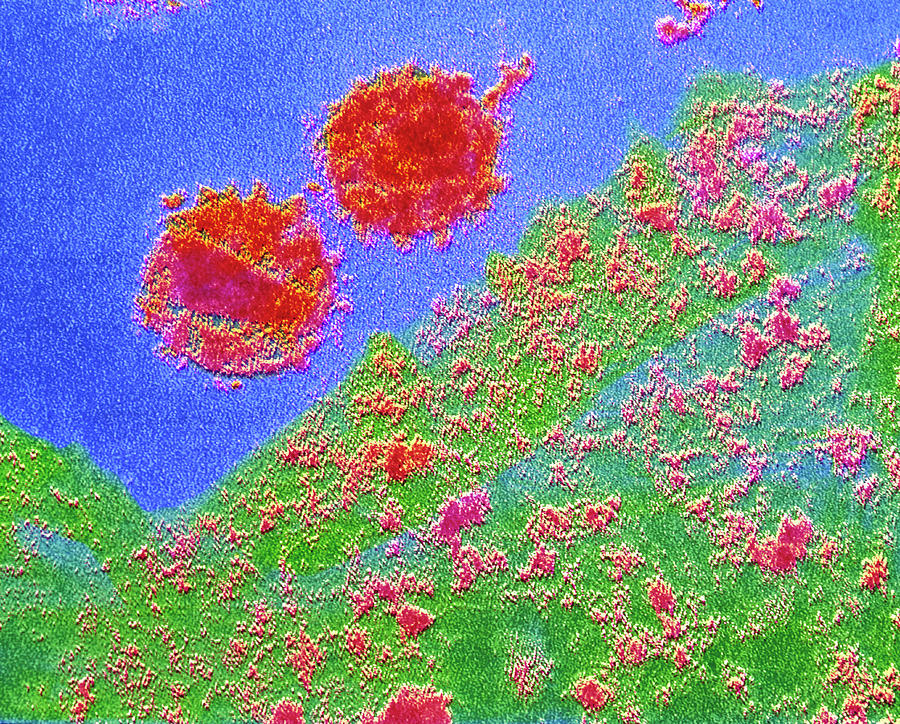 False-colour Tem Of Aids Virus Photograph by Cnri/science Photo Library