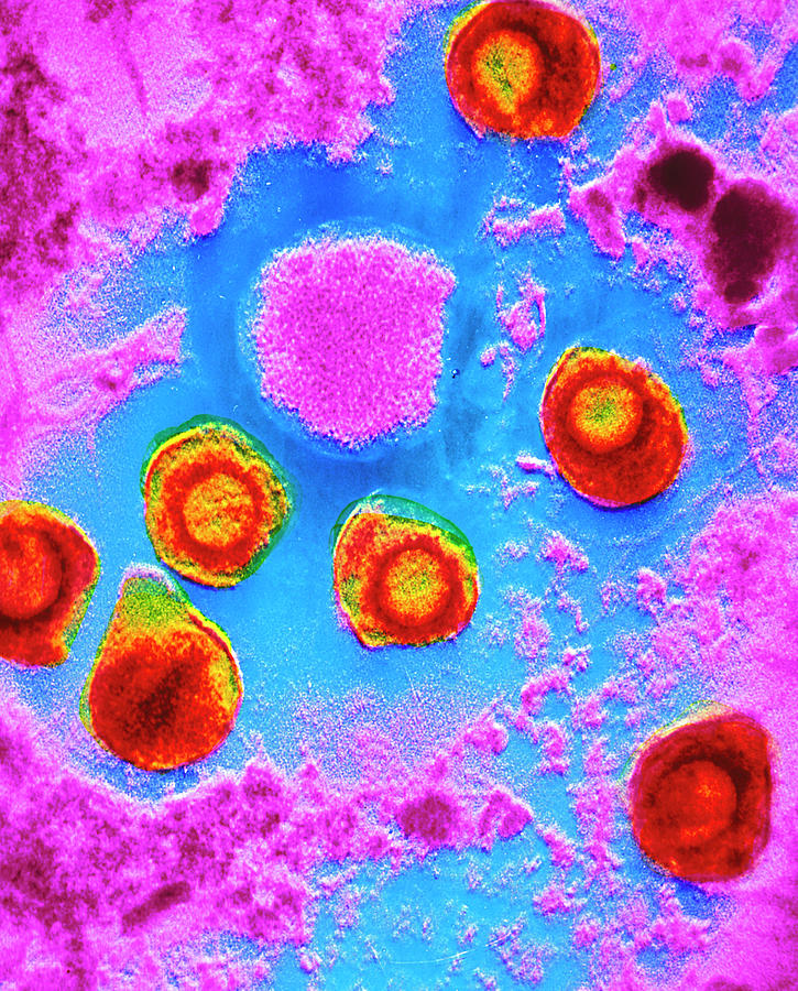 False-colour Tem Of Cytomegalovirus Particles by Cnri/science Photo Library