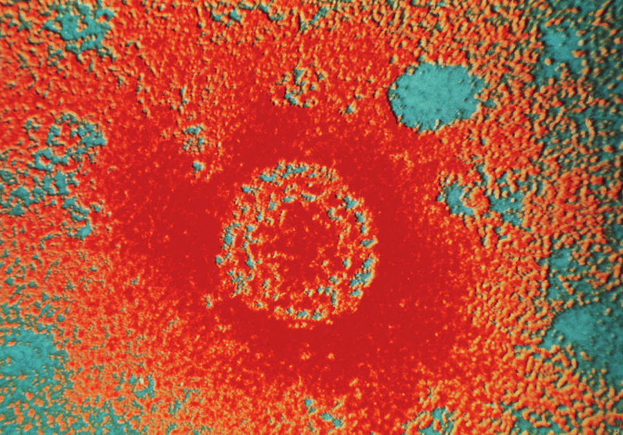 False Colour Tem Of Hepatitis B Virus Particle Photograph By Science