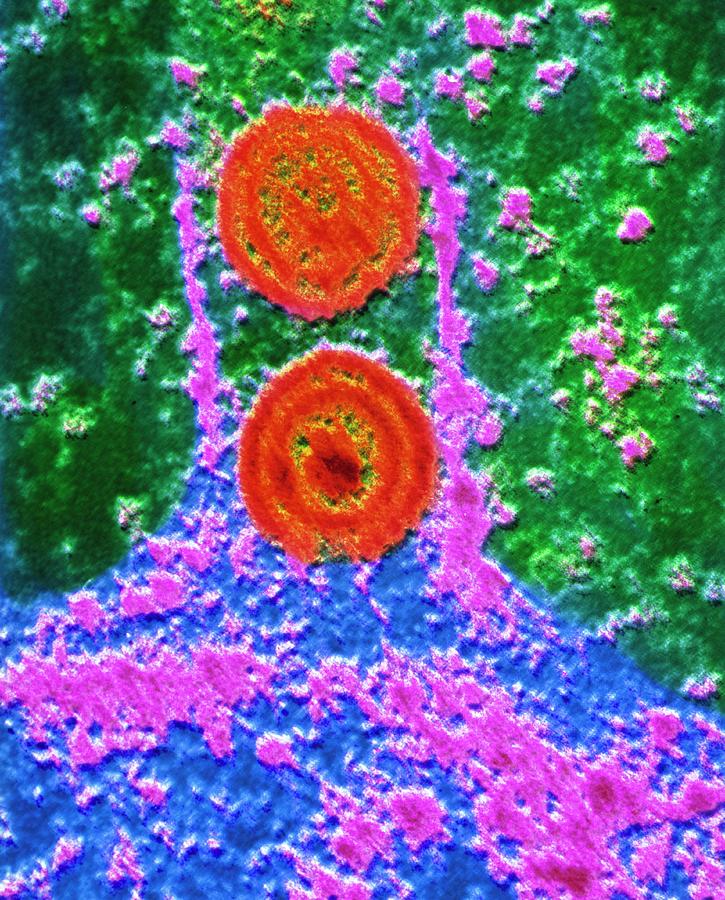 False-colour Tem Of Herpes Simplex Virus Photograph by Institut Pasteur/unite Des Virus Oncongenes/science Photo Library