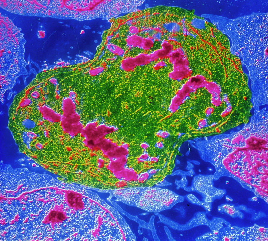 False-colour Tem Of Lymphocyte Undergoing Mitosis Photograph by Cnri/science Photo Library