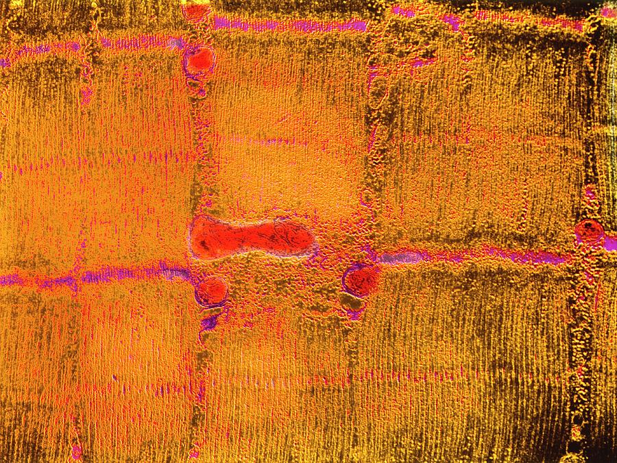 False-colour Tem Of Striated Skeletal Muscle Photograph by Cnri/science Photo Library