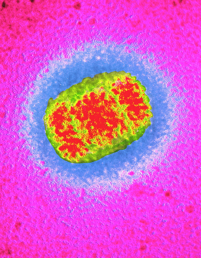 False-colour Tem Of Vaccinia Virus Particle Photograph by Cnri/science ...