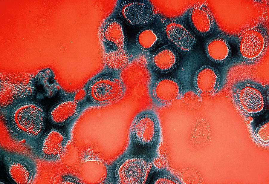 False-colour Tem Of Virions Of Influenza Virus Photograph by Nibsc ...