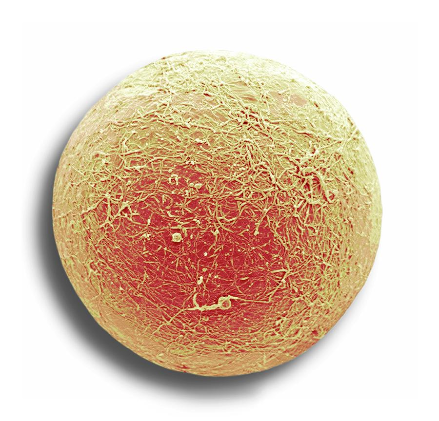 Fat Cell Photograph by Steve Gschmeissner/science Photo Library