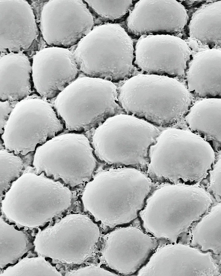 Fat Cells From Adipose Tissue Photograph by Dennis Kunkel ...