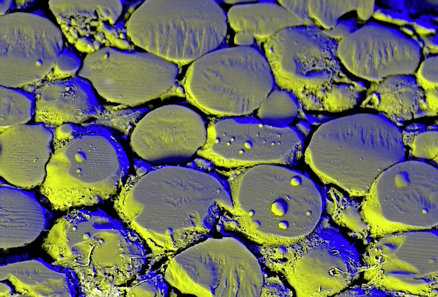 Fat Cells Photograph by Kevin Mackenzie / University Of Aberdeen ...