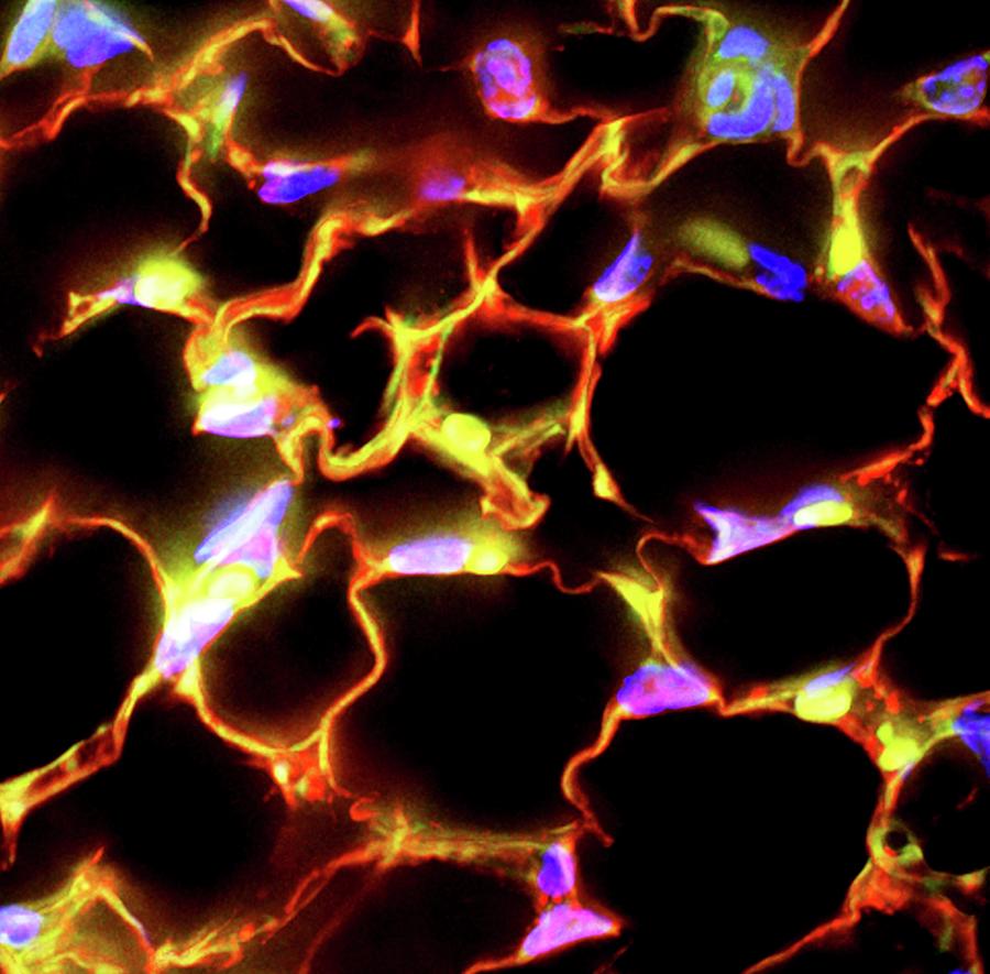 Fat Cells Photograph by R. Bick, B. Poindexter, Ut Medical School/science Photo Library