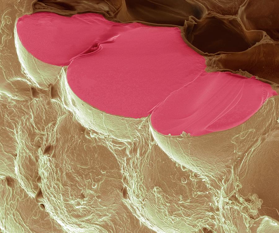 Fat Cells Photograph by Steve Gschmeissner/science Photo Library