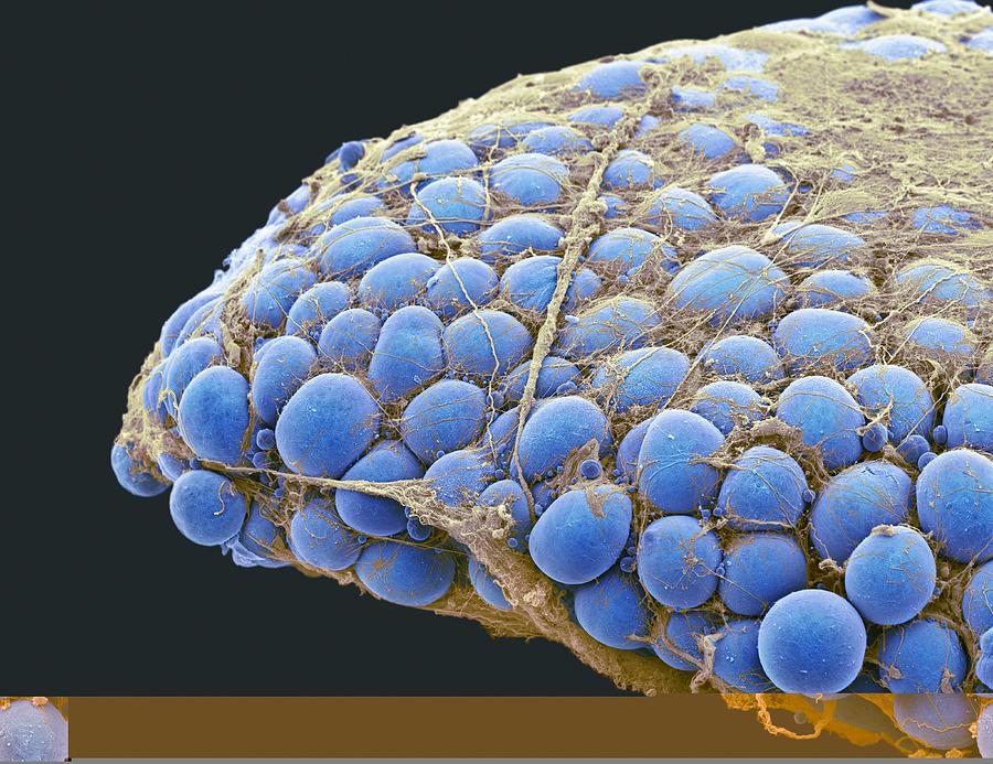 Fat tissue, SEM Photograph by Science Photo Library