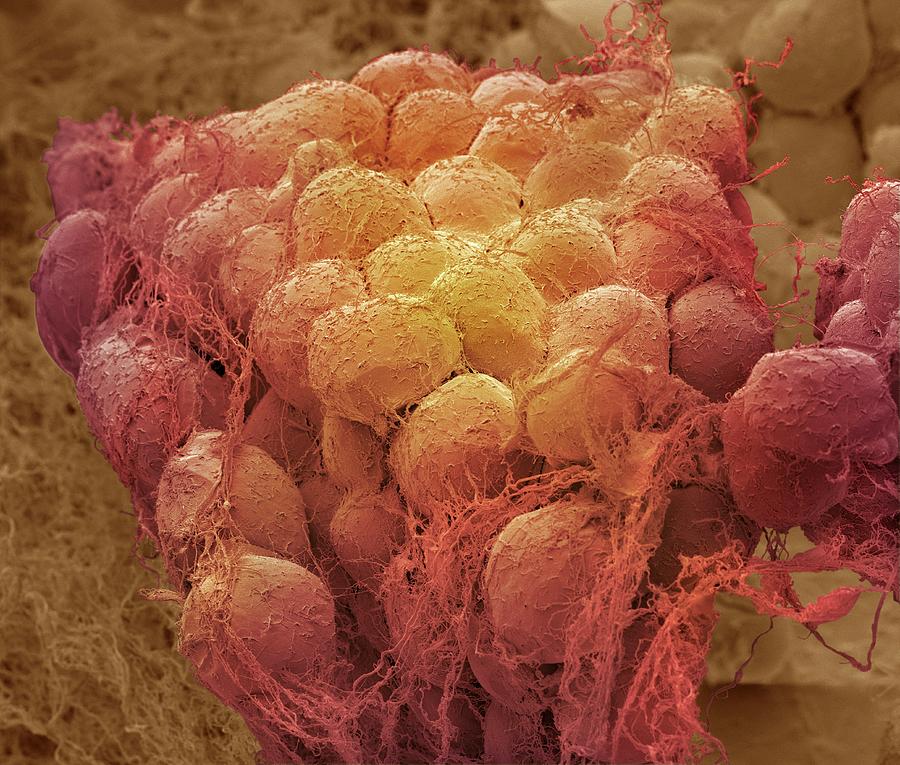 Fat Tissue Photograph by Steve Gschmeissner