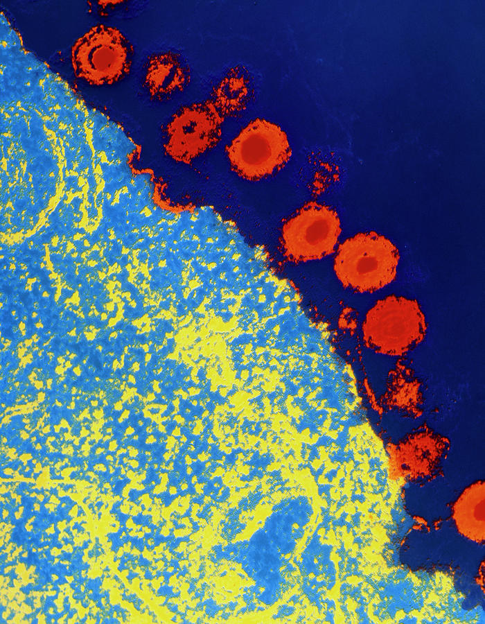 F/colour Tem Of Human Herpes Virus Type 6 On Cell Photograph by A.b. Dowsett/science Photo Library