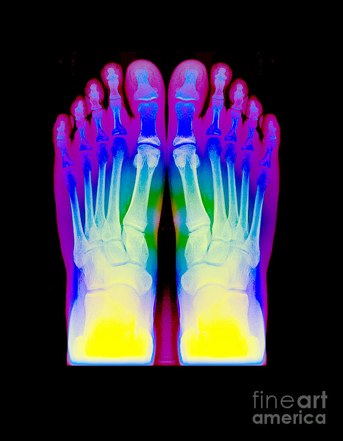 Feet, X-ray Photograph by Living Art Enterprises