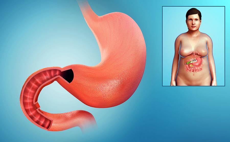 Female Stomach And Duodenum Photograph by Pixologicstudio/science Photo Library