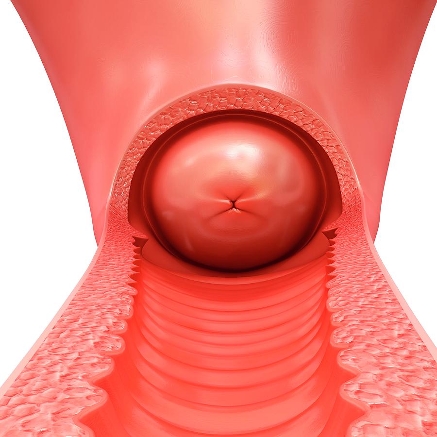 Female Vagina And Cervix By Pixologicstudio Science Photo Library