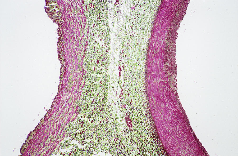 Artery Photograph - Femoral Vein And Artery by Astrid & Hanns-frieder Michler/science Photo Library