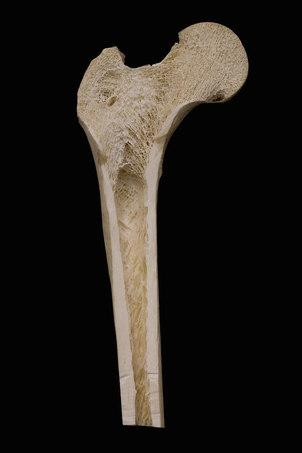 Femur Longitudinal Section, Lm Photograph by Science Stock Photography