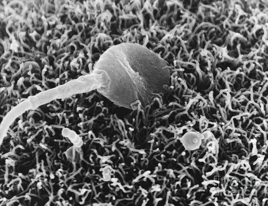 Fertilization Sem Photograph By David M Phillips