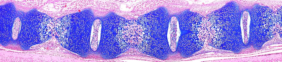 Fetal Vertebral Column Photograph by Microscape