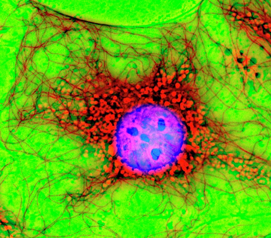 Fibroblast Cell Photograph by Dr Jan Schmoranzer/science Photo Library