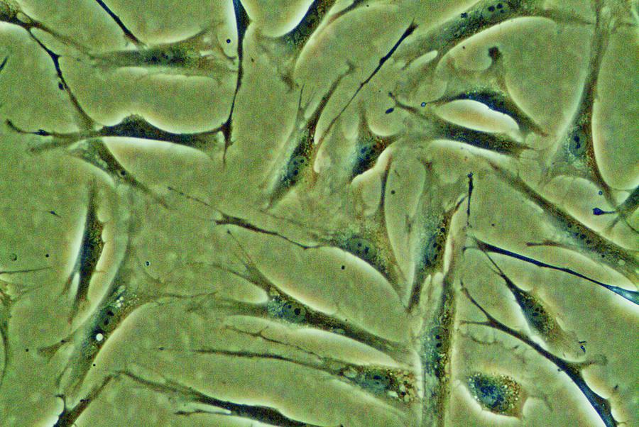 Fibroblast Stem Cells Photograph by Andy Crump/science Photo Library