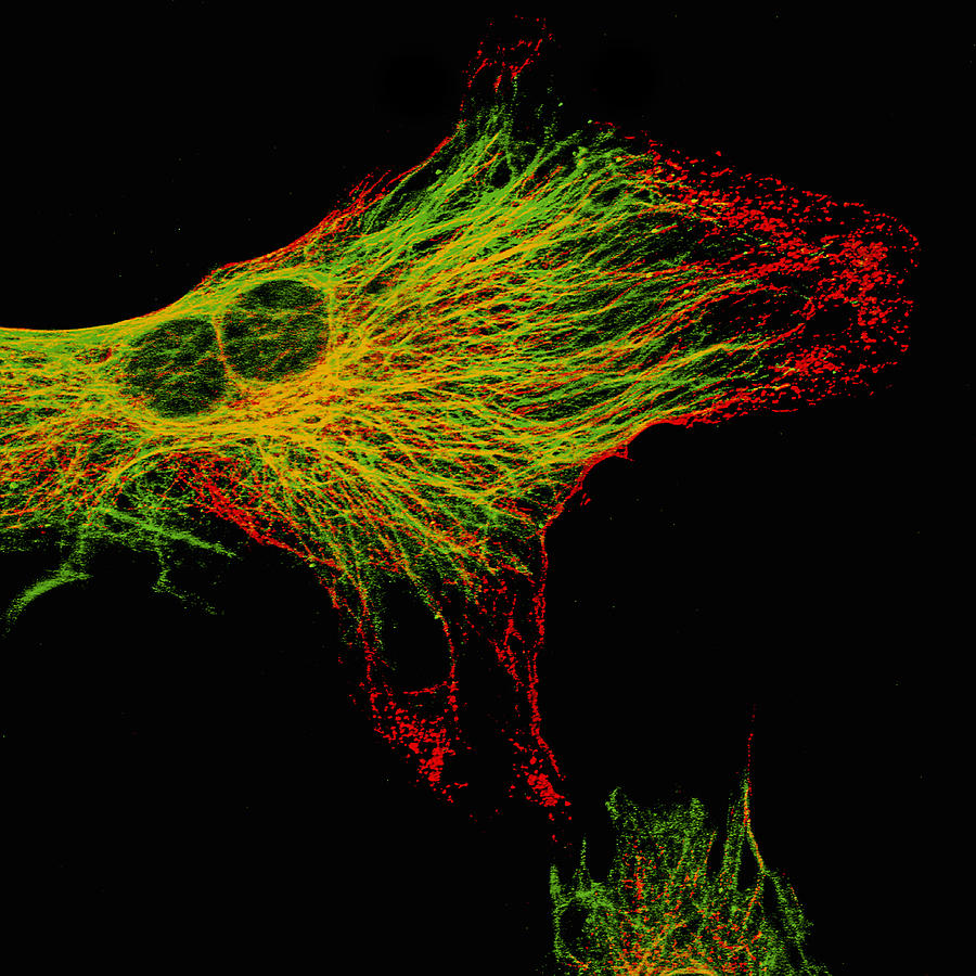 Fibroblasts, 4 Of 4 Photograph by Alvin Telser