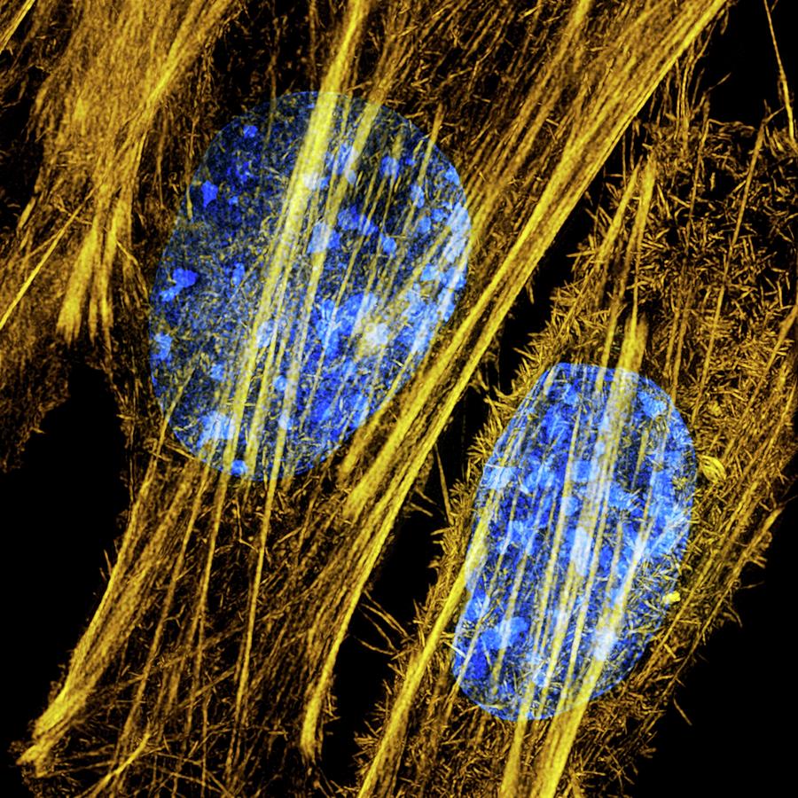 Fibroblasts Photograph by Dr Lothar Schermelleh