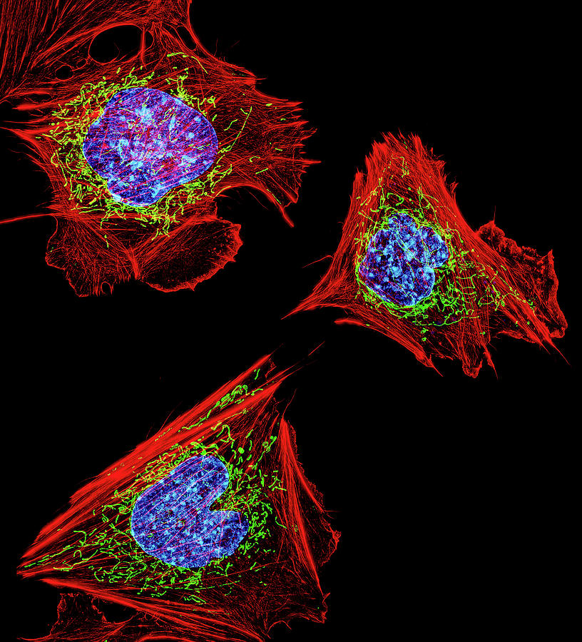 Mouse Photograph - Fibroblasts by National Institutes Of Health