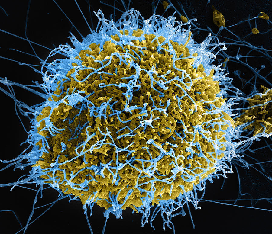 Filamentous Ebola virus particles (colored blue) budding from a chronically-infected VERO E6 cell (colored yellow) Photograph by Callista Images