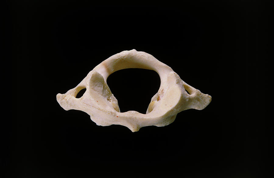 First Cervical (atlas) Vertebra Of Neck Photograph by James Stevenson/science Photo Library.