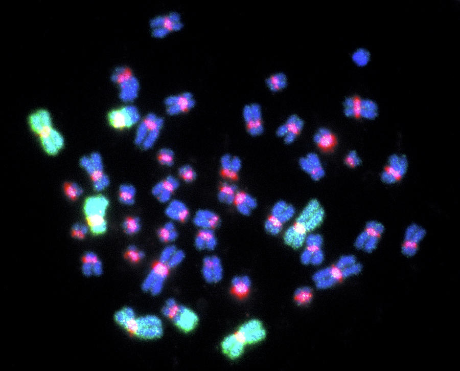 Fish Micrograph Of Abnormal Chromosomes Photograph by Public Health ...