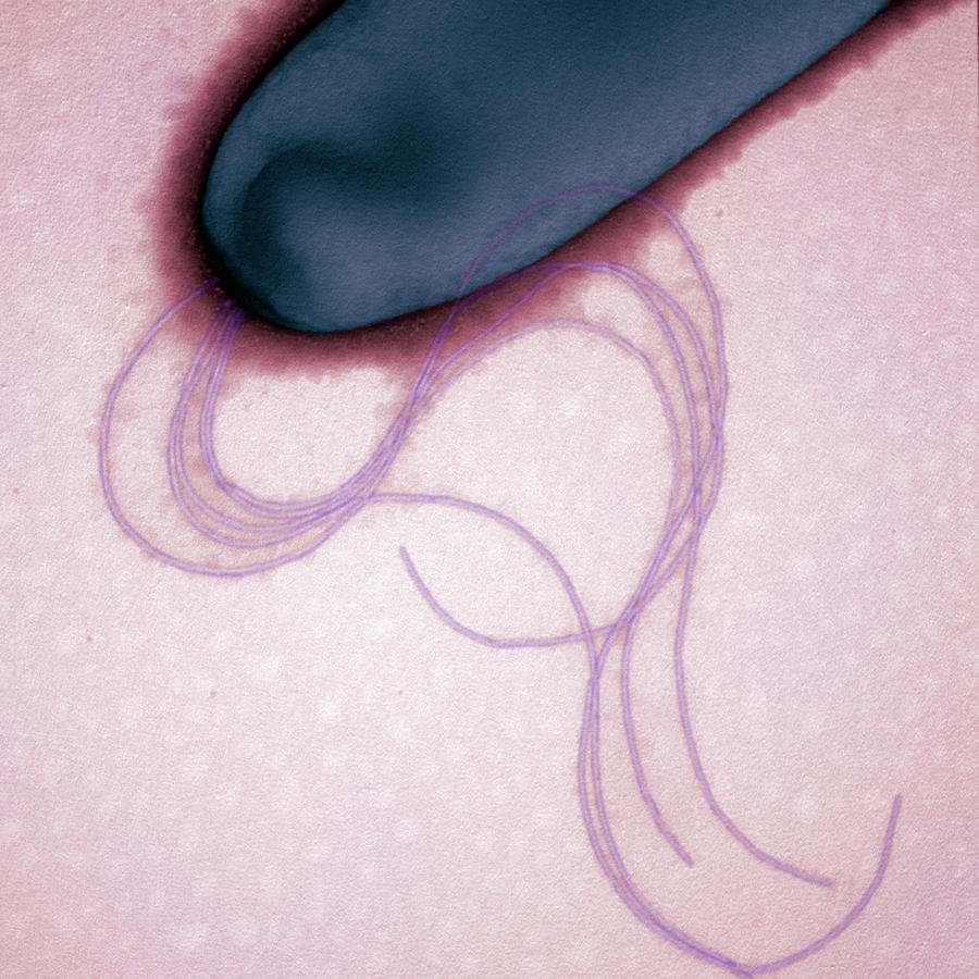 Electron Micrograph Photograph - Flagella Of Pseudomonas Aeruginosa by Science Stock Photography