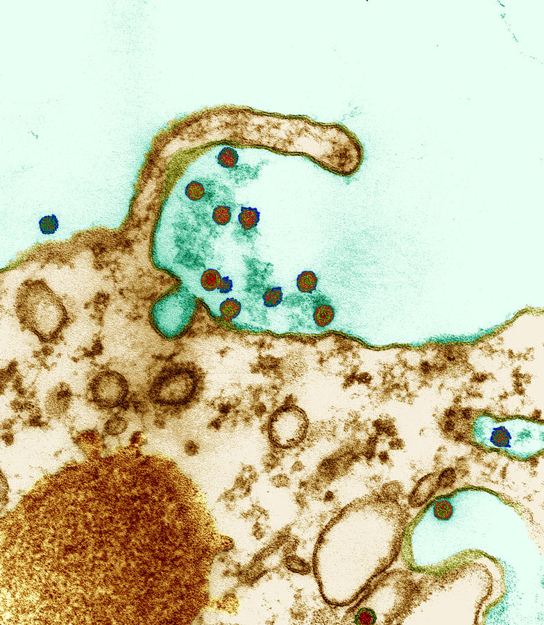 Flaviviruses Photograph by Eye of Science