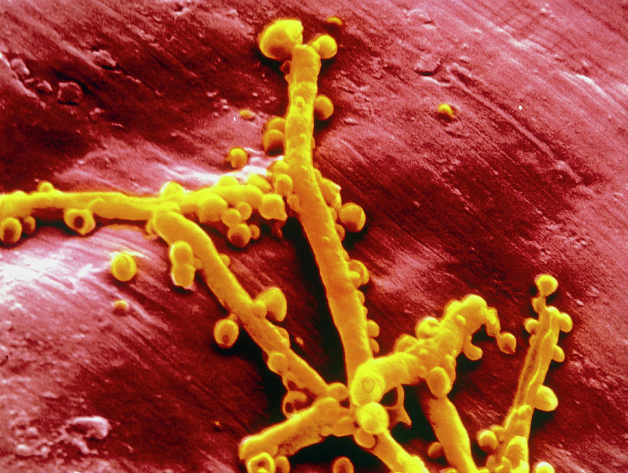 Flavobacterium Meningo Septicum Bacteria Photograph By Cnriscience
