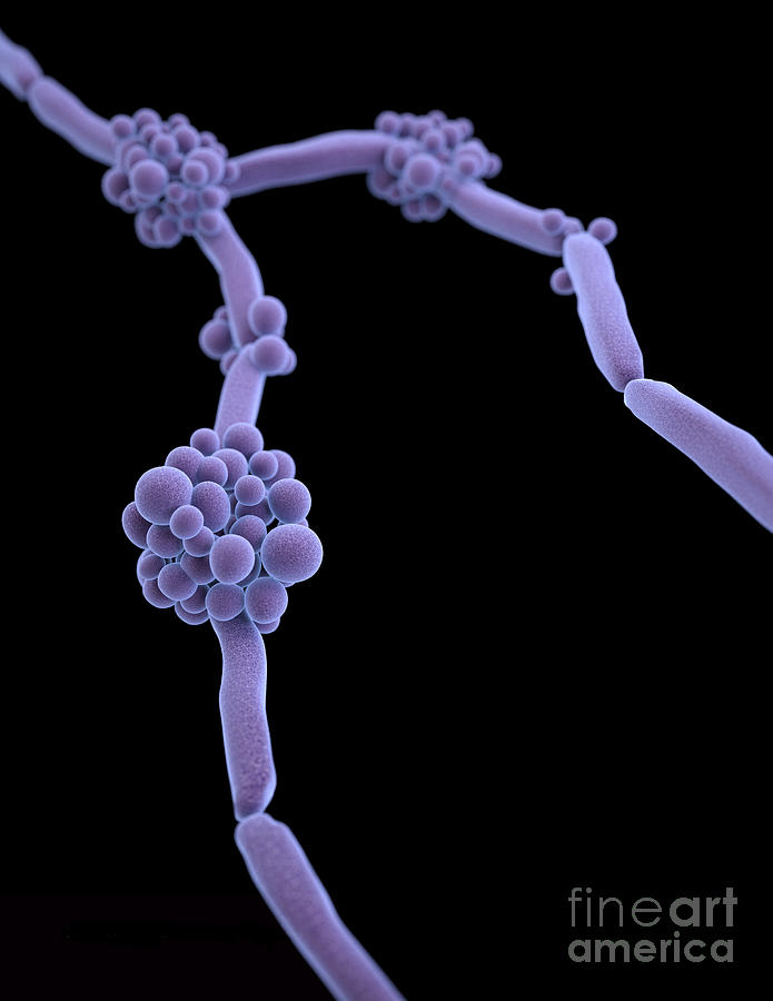 Fluconazole-resistant Candida Photograph by Science Source