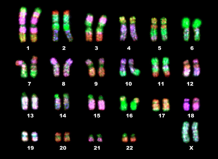 Fluorescence Lm Of A Normal Human Female Karyotype Photograph by Dept ...