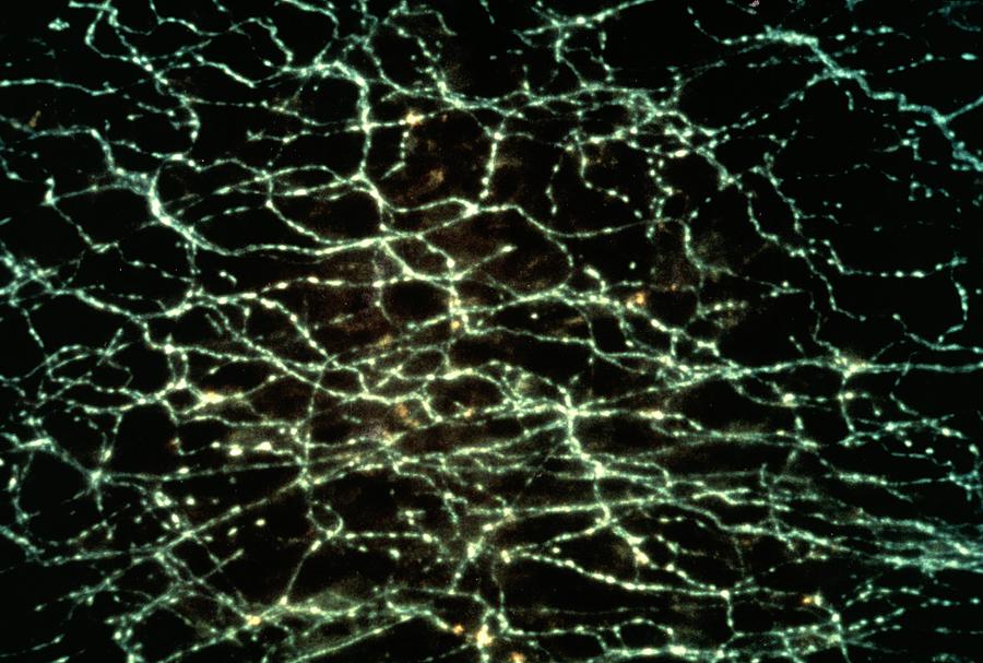 Fluorescence Micrograph Of Nerve Fibres by Dr David Jacobowitz/science ...