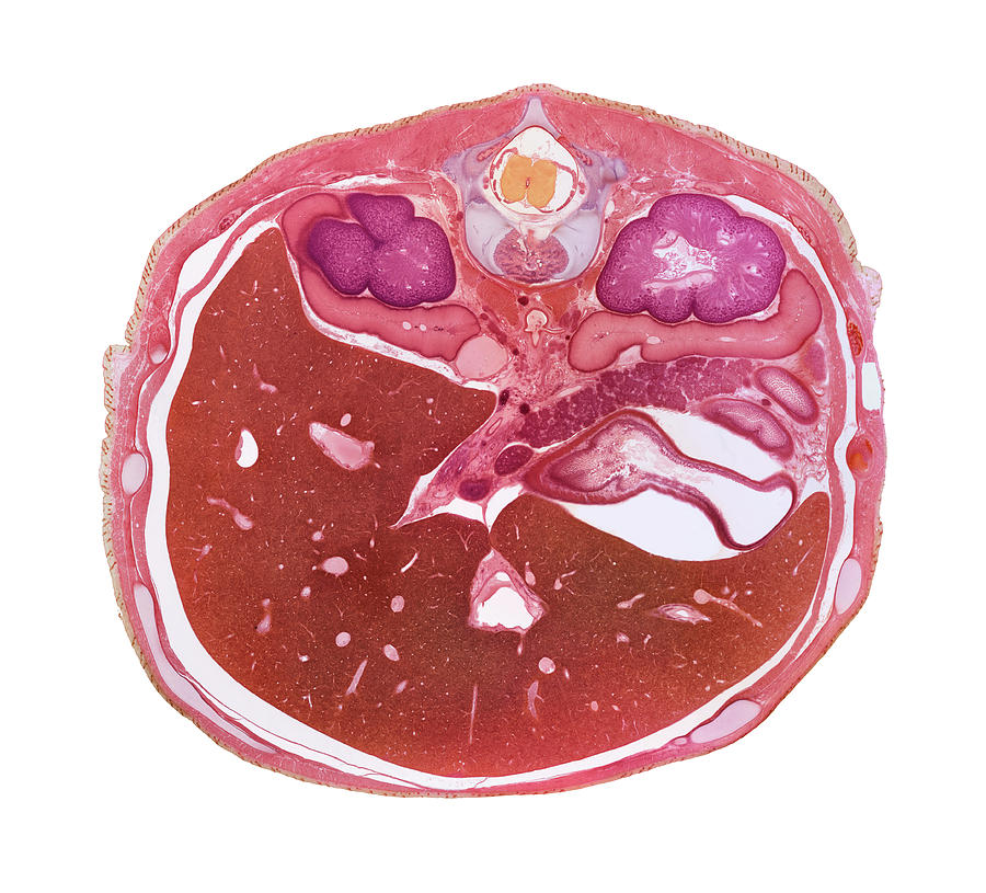 Foetal Liver Photograph by Photo Quest Ltd/science Photo Library