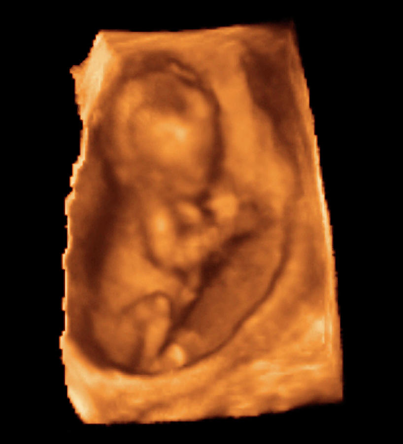 Foetus At 14 Weeks Photograph by Dr Najeeb Layyous/science Photo Library