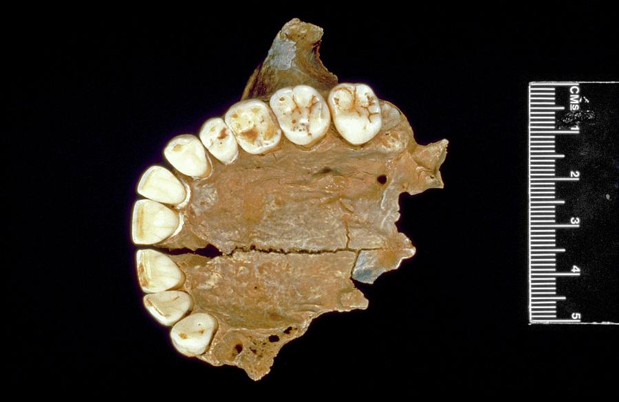 Adolescent Photograph - Fossil Human Upper Jaw by Natural History Museum, London/science Photo Library Adolescent Photograph - Fossil Human Upper Jaw by Natural History Museum, London/science Photo Library